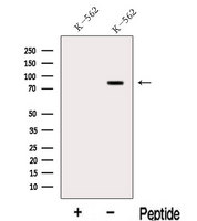 LPO / Lactoperoxidase Antibody - Western blot analysis of extracts of K562 cells using LPO antibody. The lane on the left was treated with blocking peptide.