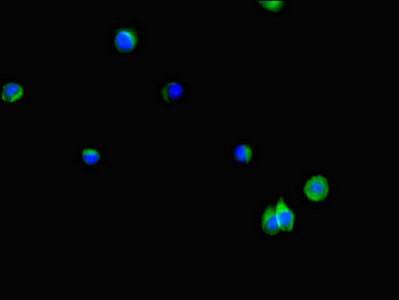 LPP3 / PPAP2B Antibody - Immunofluorescent analysis of Hela cells using PLPP3 Antibody at dilution of 1:100 and Alexa Fluor 488-congugated AffiniPure Goat Anti-Rabbit IgG(H+L)