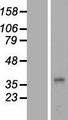 LPPR1 Protein - Western validation with an anti-DDK antibody * L: Control HEK293 lysate R: Over-expression lysate