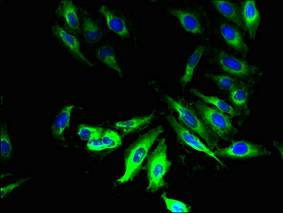 LPPR2 Antibody - Immunofluorescent analysis of Hela cells diluted at 1:100 and Alexa Fluor 488-congugated AffiniPure Goat Anti-Rabbit IgG(H+L)