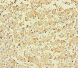 LPPR2 Antibody - Immunohistochemistry of paraffin-embedded human liver tissue at dilution 1:100