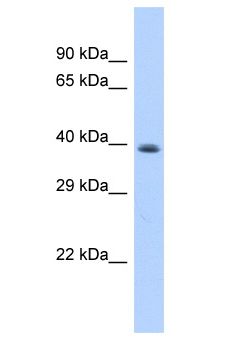 LPPR3 Antibody - LPPR3 antibody Western Blot of HeLa. Antibody dilution: 1 ug/ml.  This image was taken for the unconjugated form of this product. Other forms have not been tested.