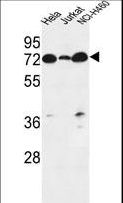 LPPR4 / PRG1 Antibody - LPPR4 Antibody western blot of HeLa,Jurkat,NCI-H460 cell line lysates (35 ug/lane). The LPPR4 antibody detected the LPPR4 protein (arrow).