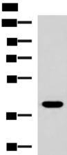 LPPR5 Antibody - Western blot analysis of HepG2 cell lysate  using PLPPR5 Polyclonal Antibody at dilution of 1:1500