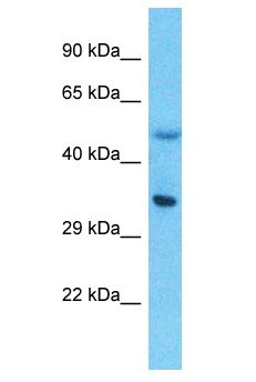 LPPR5 Antibody - LPPR5 antibody Western Blot of Thymus Tumor. Antibody dilution: 1 ug/ml.  This image was taken for the unconjugated form of this product. Other forms have not been tested.