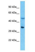 LPPR5 Antibody - LPPR5 antibody Western Blot of Thymus Tumor. Antibody dilution: 1 ug/ml.  This image was taken for the unconjugated form of this product. Other forms have not been tested.