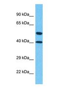 LPXN / Leupaxin Antibody - Western blot of LPXN Antibody with human Jurkat Whole Cell lysate.  This image was taken for the unconjugated form of this product. Other forms have not been tested.