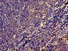 LPXN / Leupaxin Antibody - Immunohistochemistry of paraffin-embedded human lymph node tissue using LPXN Antibody at dilution of 1:100