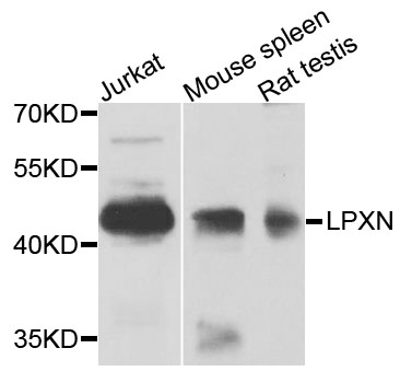 LPXN / Leupaxin Antibody - Western blot analysis of extracts of various cells.