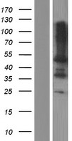 LPXN / Leupaxin Protein - Western validation with an anti-DDK antibody * L: Control HEK293 lysate R: Over-expression lysate