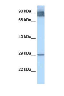 LRAT Antibody - LRAT antibody Western blot of 1 Cell lysate. Antibody concentration 1 ug/ml.  This image was taken for the unconjugated form of this product. Other forms have not been tested.