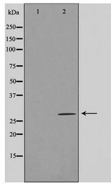 LRAT Antibody - Western blot of COLO205 cell lysate using LRAT Antibody