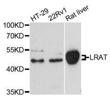 LRAT Antibody - Western blot analysis of extracts of various cell lines, using Lrat antibody at 1:3000 dilution. The secondary antibody used was an HRP Goat Anti-Rabbit IgG (H+L) at 1:10000 dilution. Lysates were loaded 25ug per lane and 3% nonfat dry milk in TBST was used for blocking. An ECL Kit was used for detection and the exposure time was 90s.