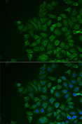 LRAT Antibody - Immunofluorescence analysis of MCF7 cells using LRAT antibody. Blue: DAPI for nuclear staining.