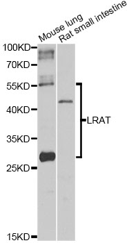 LRAT Antibody - Western blot analysis of extracts of various cell lines, using Lrat antibody at 1:1000 dilution. The secondary antibody used was an HRP Goat Anti-Rabbit IgG (H+L) at 1:10000 dilution. Lysates were loaded 25ug per lane and 3% nonfat dry milk in TBST was used for blocking. An ECL Kit was used for detection and the exposure time was 30s.