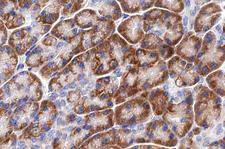 LRAT Antibody - 1:100 staining human pancreas tissue by IHC-P. The tissue was formaldehyde fixed and a heat mediated antigen retrieval step in citrate buffer was performed. The tissue was then blocked and incubated with the antibody for 1.5 hours at 22°C. An HRP conjugated goat anti-rabbit antibody was used as the secondary.