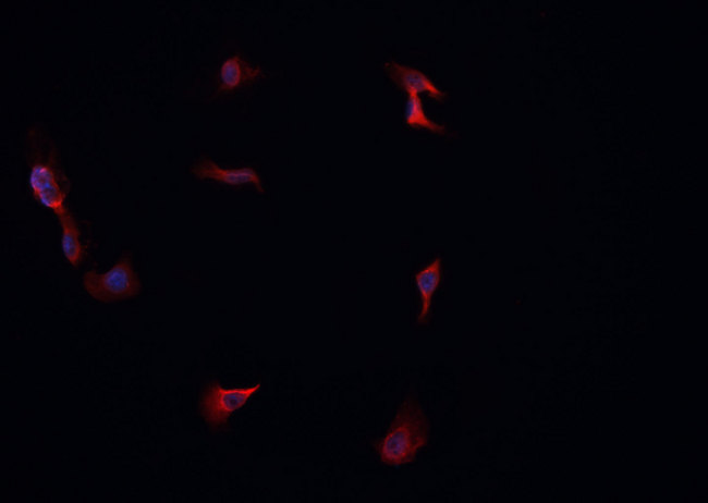LRAT Antibody - Staining A549 cells by IF/ICC. The samples were fixed with PFA and permeabilized in 0.1% Triton X-100, then blocked in 10% serum for 45 min at 25°C. The primary antibody was diluted at 1:200 and incubated with the sample for 1 hour at 37°C. An Alexa Fluor 594 conjugated goat anti-rabbit IgG (H+L) antibody, diluted at 1/600, was used as secondary antibody.