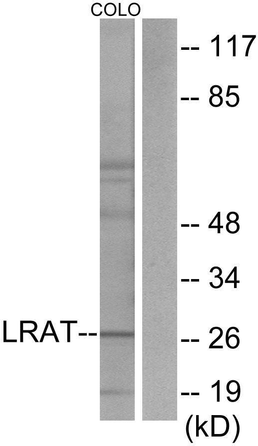 LRAT Antibody - Western blot analysis of extracts from COLO205 cells, using LRAT antibody.