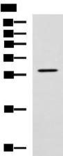 LRAT Antibody - Western blot analysis of SP20 cell lysate  using LRAT Polyclonal Antibody at dilution of 1:800