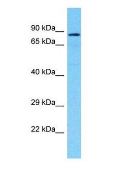 LRCH1 Antibody - Western blot of LRCH1 Antibody with HeLa Whole Cell lysate.  This image was taken for the unconjugated form of this product. Other forms have not been tested.