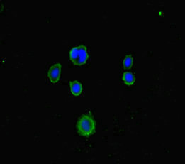 LRCH1 Antibody - Immunofluorescent analysis of MCF7 cells diluted at 1:100 and Alexa Fluor 488-congugated AffiniPure Goat Anti-Rabbit IgG(H+L)
