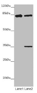 LRCH1 Antibody - Western blot All Lanes: LRCH1 antibody at 15 ug/ml Lane 1: Hela whole cell lysate Lane 2: MCF7 whole cell lysate Secondary Goat polyclonal to rabbit IgG at 1/10000 dilution Predicted band size: 81,78,85 kDa Observed band size: 81,35 kDa