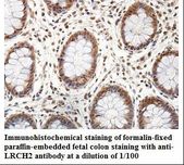 LRCH2 Antibody