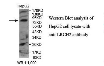 LRCH2 Antibody