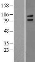 LRCH3 Protein - Western validation with an anti-DDK antibody * L: Control HEK293 lysate R: Over-expression lysate