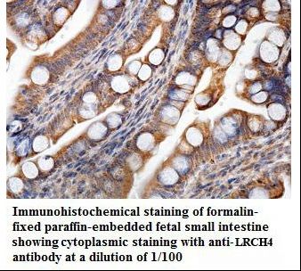 LRCH4 Antibody