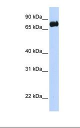 LRCH4 Antibody - Transfected 293T cell lysate. Antibody concentration: 1.0 ug/ml. Gel concentration: 12%.  This image was taken for the unconjugated form of this product. Other forms have not been tested.