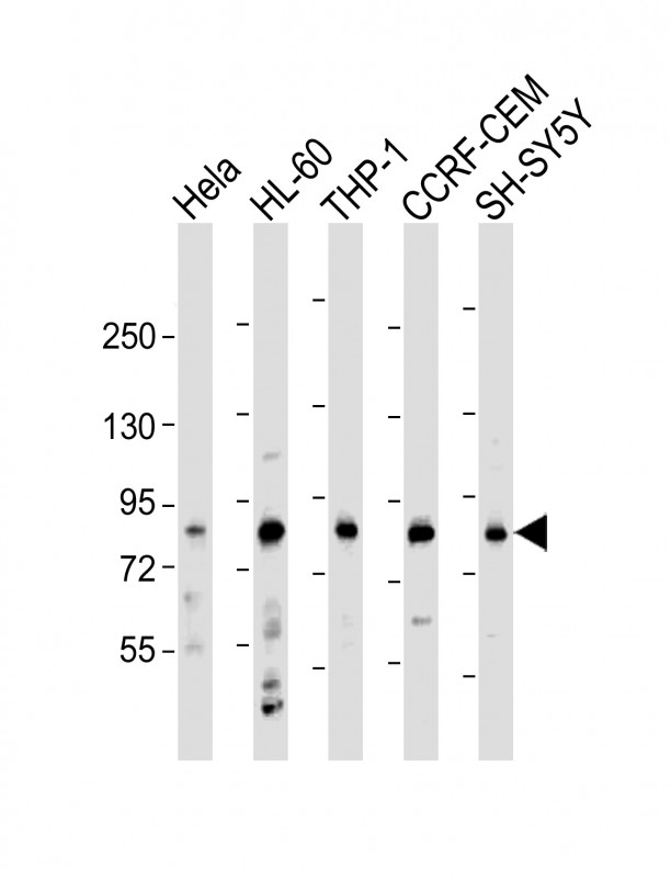 LRCH4 Antibody - All lanes: Anti-LRCH4 Antibody (Center) at 1:2000 dilution Lane 1: Hela whole cell lysate Lane 2: HL-60 whole cell lysate Lane 3: THP-1 whole cell lysate Lane 4: CCRF-CEM whole cell lysate Lane 5: SH-SY5Y whole cell lysate Lysates/proteins at 20 µg per lane. Secondary Goat Anti-Rabbit IgG, (H+L), Peroxidase conjugated at 1/10000 dilution. Predicted band size: 74 kDa Blocking/Dilution buffer: 5% NFDM/TBST.