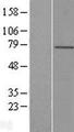LRCH4 Protein - Western validation with an anti-DDK antibody * L: Control HEK293 lysate R: Over-expression lysate