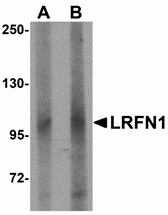 LRFN1 Antibody - Western blot of LRFN1 in human brain lysate with LRFN1 antibody at (A) 1 and (B) 2 ug/ml. Below: Immunohistochemistry of LRFN1 in mouse brain tissue with LRFN1 antibody at 2.5 ug/ml.