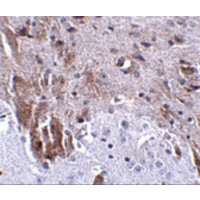 LRFN1 Antibody - Immunohistochemistry of LRFN1 in mouse brain tissue with LRFN1 antibody at 2.5 µg/mL.