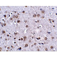 LRFN4 Antibody - Immunohistochemistry of LRFN4 in mouse brain tissue with LRFN4 antibody at 2.5 µg/mL.