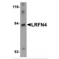 LRFN4 Antibody - Western blot analysis of LRFN4 in rat brain lysate with LRFN4 antibody at 1 µg/mL.
