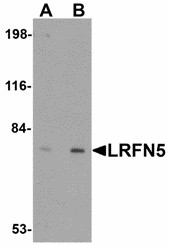 LRFN5 Antibody - Western blot of LRFN5 in EL4 cell lysate with LRFN5 antibody at (A) 0.5 and (B) 1 ug/ml. Below: Immunohistochemistry of LRFN5 in mouse brain tissue with LRFN5 antibody at 5 ug/ml.