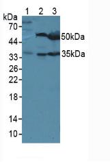 LRG1 / LRG Antibody - Western Blot; Sample. Lane1: Mouse Sp2/0 Cells; Lane2: Mouse Liver Tissue; Lane3: Mouse Pancreas Tissue.
