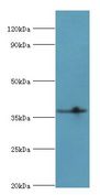 LRG1 / LRG Antibody - Western blot. All lanes: Leucine-rich alpha-2-glycoprotein antibody at 4 ug/ml+HepG2 whole cell lysate. Secondary antibody: Goat polyclonal to rabbit at 1:10000 dilution. Predicted band size: 38 kDa. Observed band size: 38 kDa.