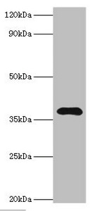 LRG1 / LRG Antibody - Western blot All lanes: Leucine-rich alpha-2-glycoprotein antibody at 4µg/ml + HepG2 whole cell lysate Secondary Goat polyclonal to rabbit IgG at 1/10000 dilution Predicted band size: 38 kDa Observed band size: 38 kDa