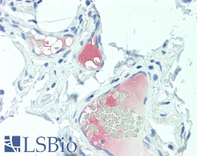 LRG1 / LRG Antibody - Human Small Intestine, Vessels: Formalin-Fixed, Paraffin-Embedded (FFPE)