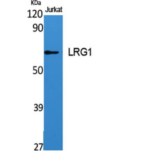 LRG1 / LRG Antibody - Western blot of LRG1 antibody