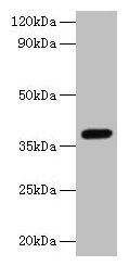 LRG1 / LRG Antibody - Western blot All lanes: LRG1 antibody at 2µg/ml + Mouse liver tissue Secondary Goat polyclonal to rabbit IgG at 1/10000 dilution Predicted band size: 38 kDa Observed band size: 38 kDa