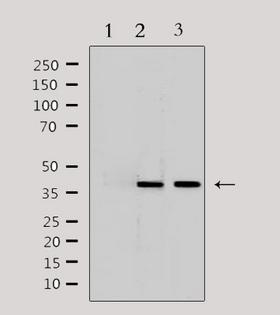 LRG1 / LRG Antibody - Western blot analysis of extracts of various samples using LRG1 antibody. Lane 1: 293 treated with blocking peptide; Lane 2: 293; Lane 3: HeLa;