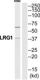 LRG1 / LRG Antibody - Western blot analysis of extracts from K562 cells, using A2GL antibody.