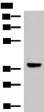 LRG1 / LRG Antibody - Western blot analysis of Mouse liver tissue lysate  using LRG1 Polyclonal Antibody at dilution of 1:1000