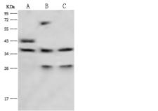 LRG1 / LRG Antibody - Anti-LRG1 rabbit polyclonal antibody at 1:500 dilution. Lane A: HepG2 Whole Cell Lysate. Lane B: 293T Whole Cell Lysate. Lane C: HL60 Whole Cell Lysate. Lysates/proteins at 30 ug per lane. Secondary: Goat Anti-Rabbit IgG (H+L)/HRP at 1/10000 dilution. Developed using the ECL technique. Performed under reducing conditions. Predicted band size: 38 kDa. Observed band size: 38 kDa.