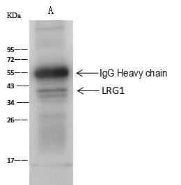 LRG1 / LRG Antibody - LRG1 was immunoprecipitated using: Lane A: 0.5 mg HepG2 Whole Cell Lysate. 2 uL anti-LRG1 rabbit polyclonal antibody and 60 ug of Immunomagnetic beads Protein A/G. Primary antibody: Anti-LRG1 rabbit polyclonal antibody, at 1:100 dilution. Secondary antibody: Goat Anti-Rabbit IgG (H+L)/HRP at 1/10000 dilution. Developed using the ECL technique. Performed under reducing conditions. Predicted band size: 38 kDa. Observed band size: 38 kDa.