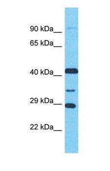 LRGUK Antibody - Western blot of LRGUK Antibody with NCI-H226 Whole Cell lysate.  This image was taken for the unconjugated form of this product. Other forms have not been tested.